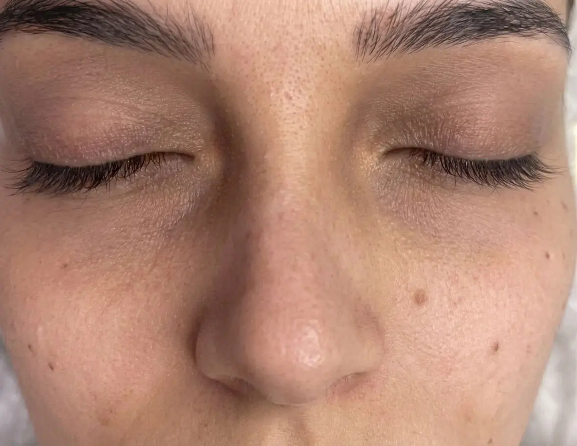 Après Peeling Cernes & Regard