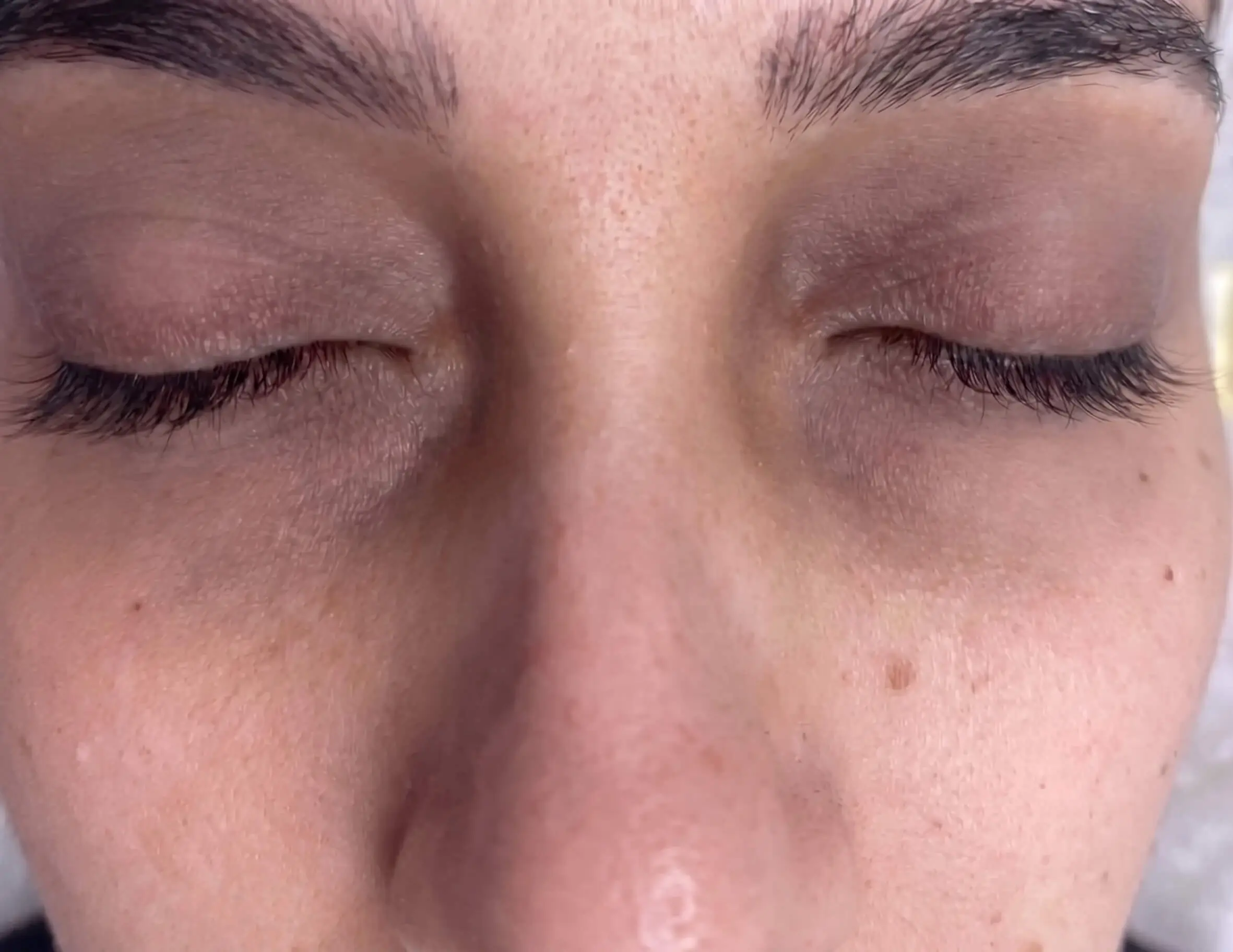 Avant Peeling Cernes & Regard